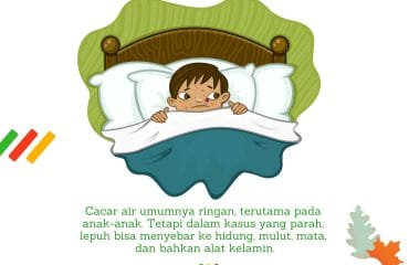 cacar air