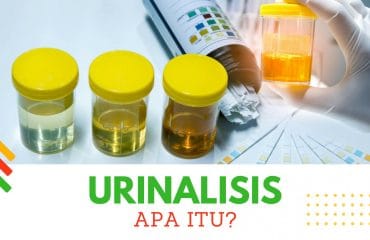 urinalisis