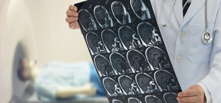 Apa Itu Radiologi dan Fungsinya untuk Kesehatan?