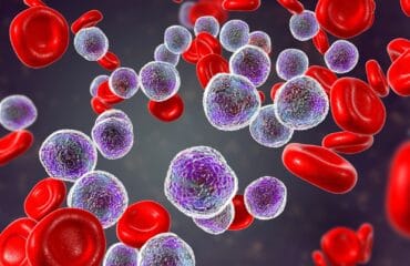 leukemia adalah