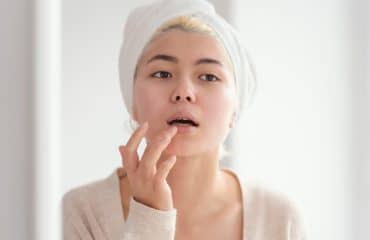 cara mengatasi bibir pecah-pecah