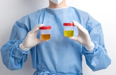 warna urine tanda diabetes