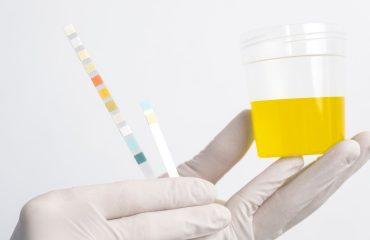 warna urine normal adalah kuning pucat