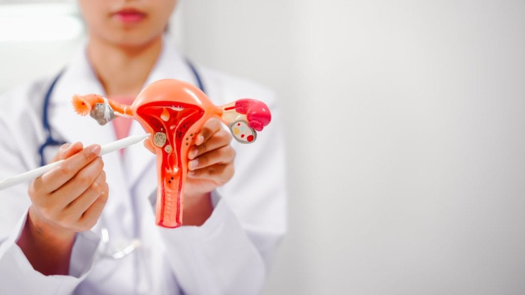 penyebab endometriosis