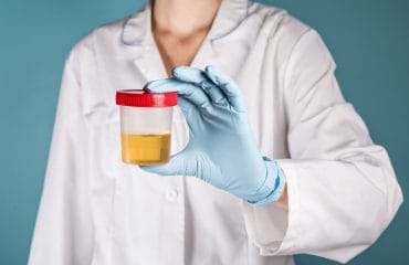 Ciri-ciri urine tidak normal