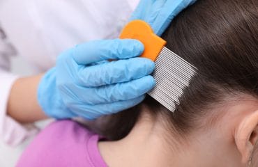 cara menghilangkan kutu rambut