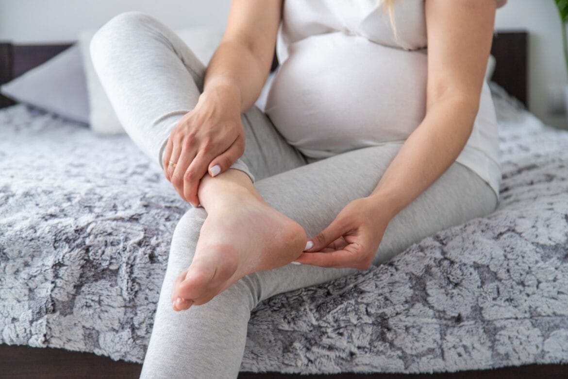 Penyebab kaki bengkak saat hamil