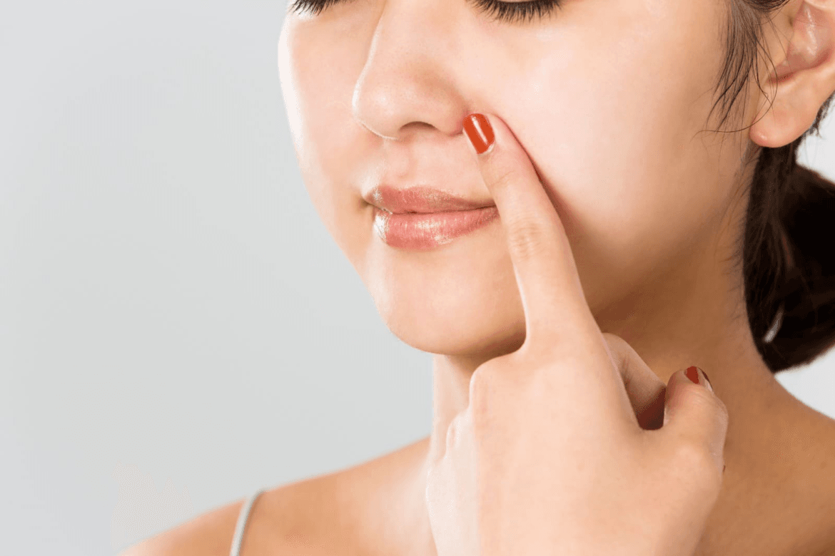 cara menghilangkan komedo secara alami