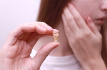 tanda gigi bungsu bermasalah