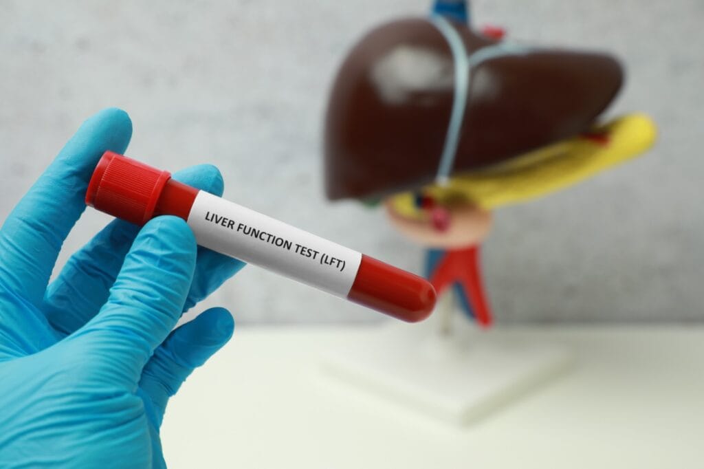 pemeriksaan fungsi hati