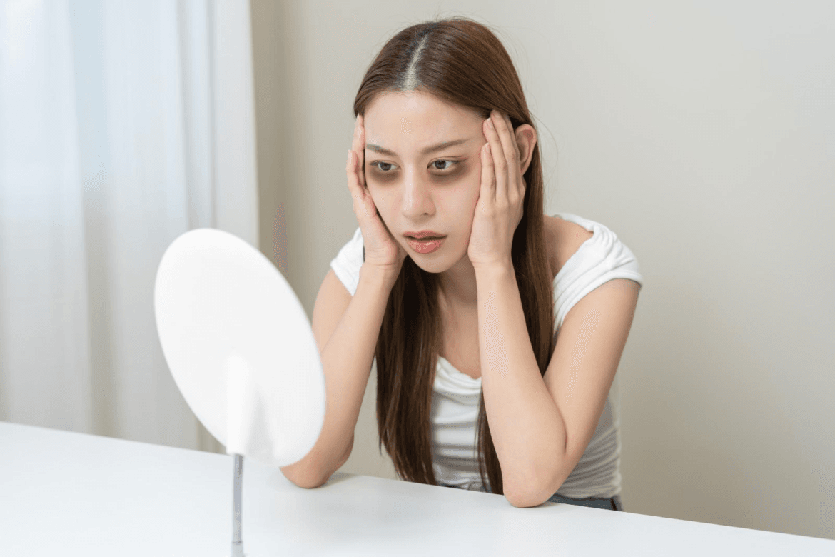 cara menghilangkan mata panda