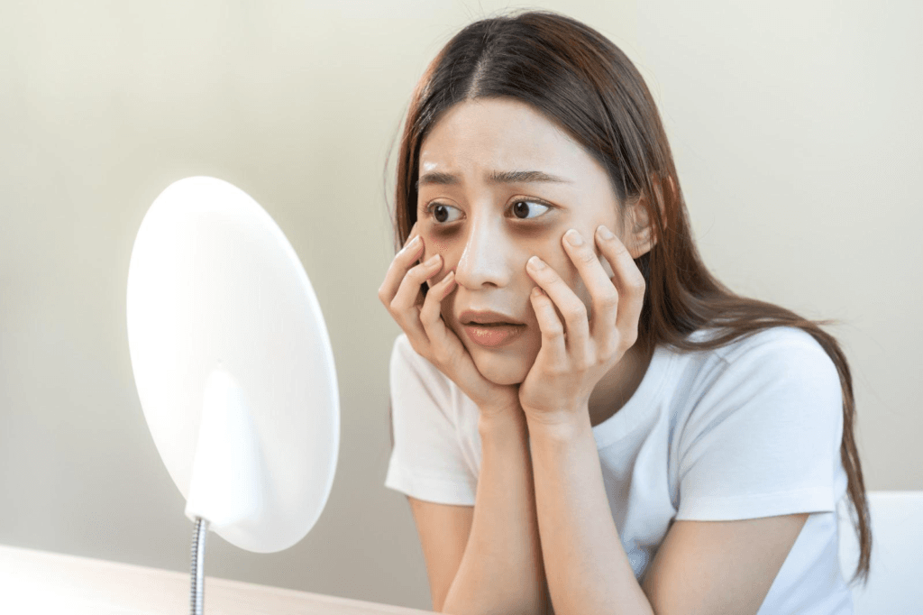 cara menghilangkan mata sembab