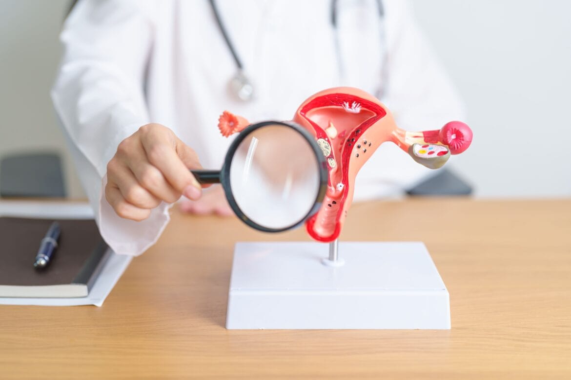 cara mengobati penebalan dinding rahim secara alami