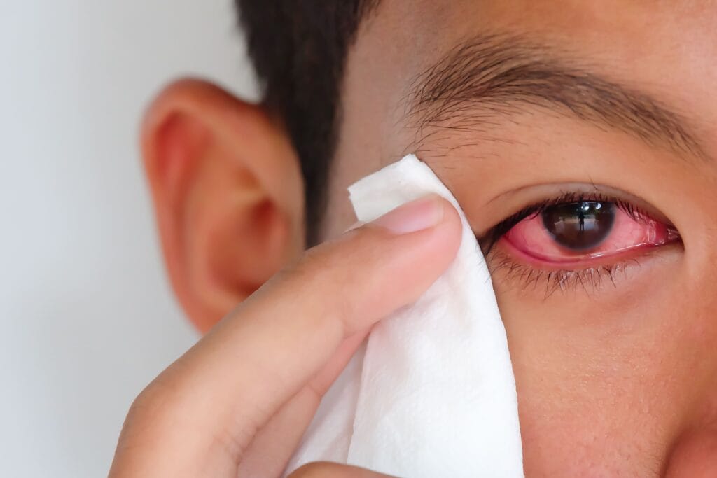 macam-macam penyakit mata