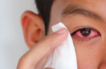 macam-macam penyakit mata