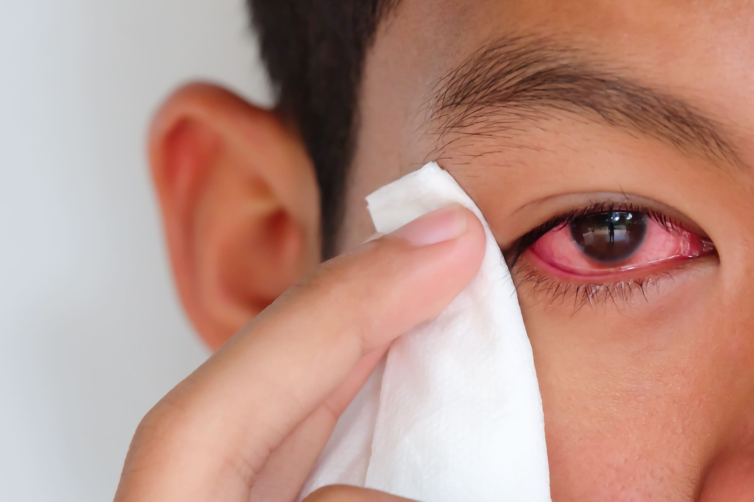 18 Macam-macam penyakit mata dan cara mengatasinya