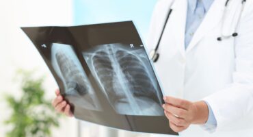 Pembengkakan jantung