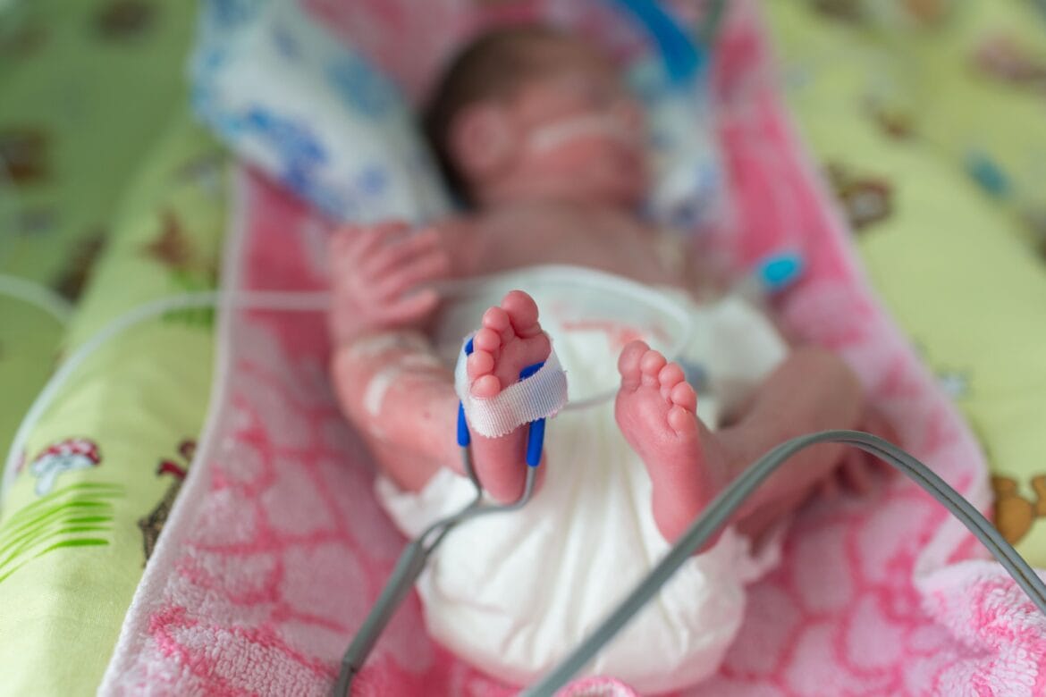 jantung bocor pada bayi