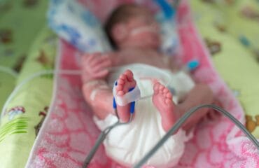 jantung bocor pada bayi