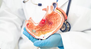 penyebab kanker lambung