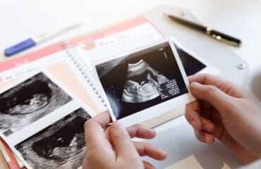 gerakan janin yang tidak normal