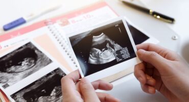 gerakan janin yang tidak normal