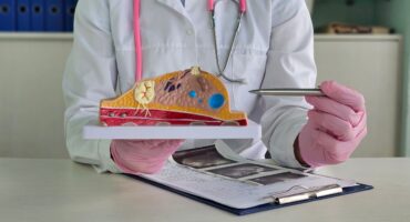 berapa lama kanker payudara menyebar