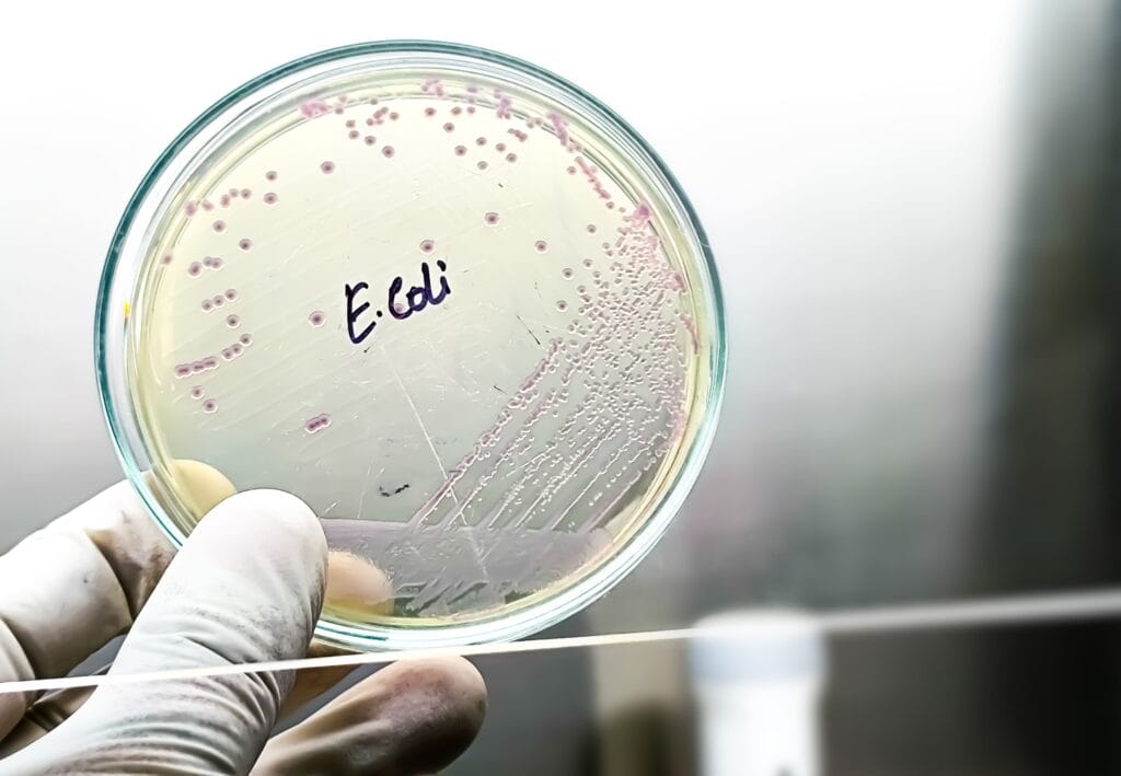 Escherichia coli adalah
