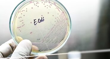 Escherichia coli adalah