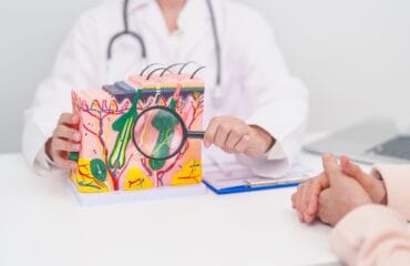 Penyakit yang ditangani dokter spesialis kulit