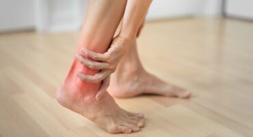 cara mengobati kaki keseleo agar cepat sembuh