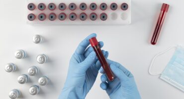 hitung darah lengkap